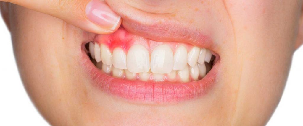Kadın Sağlığı ve Diş Problemleri